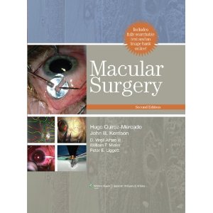 Macular Surgery 2/E 2011
