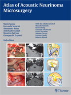 Atlas of Acoustic Neurinoma Microsurgery 2011