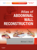 Atlas of Abdominal Wall Reconstruction Expert Consult - Online and Print