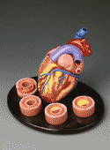 Heart Conditions Model