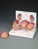 Mini Heart Set Models