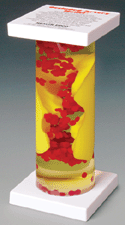 Occluded Artery Model