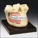 Upper and Lower Jaw Model