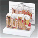 Diseased Teeth and Gums Model