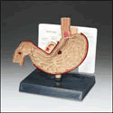 Stomach with Ulcers Model