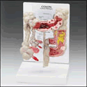 Colon Model