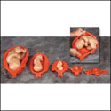 Uterus With Fetus Model Set