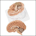 Two-Part Brain Model