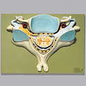 Fifth Cervical Vertebra