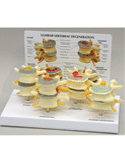 Four Stage Vertebrae Set