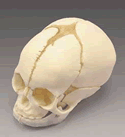 Fetal Skull