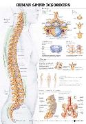 Human Spine Disorders Anatomical Chart Laminated