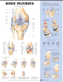 Knee Injuries Anatomical Chart Laminated