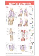 Athletic Injuries of the Knee Anatomical Chart Laminated