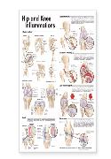Hip and Knee Inflammations Anatomical Chart Laminated