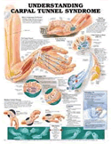 Understanding Carpal Tunnel Syndrome Anatomical Chart Laminated