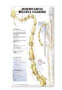 Understanding Multiple Sclerosis Anatomical Chart Laminated