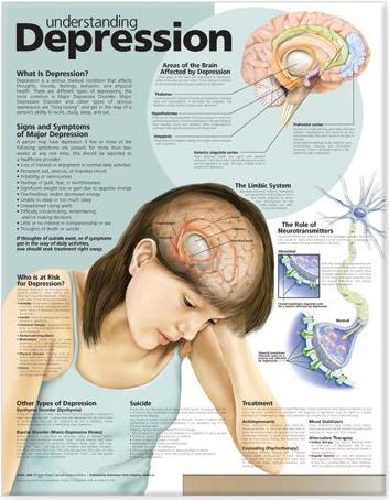 Understanding Depression Anatomical Chart Laminated