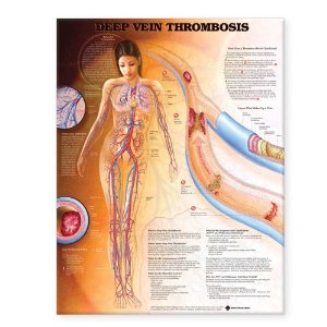 Deep Vein Thrombosis Anatomical Chart Laminated