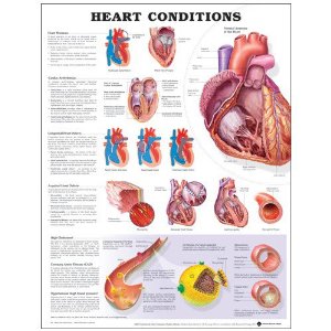 Heart Conditions Laminated