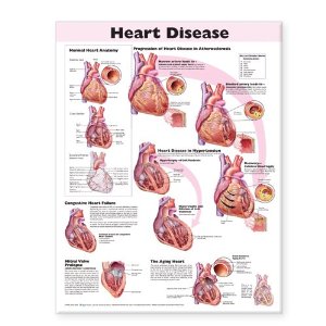 Heart Disease Anatomical Chart Laminated
