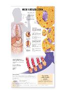 High Cholesterol Anatomical Chart Laminated