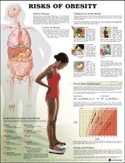 Risks of Obesity Anatomical Chart Laminated