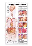 Understanding Diabetes Anatomical Chart Laminated
