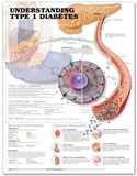 Understanding Type 1 Diabetes Anatomical Chart Laminated