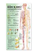 Understanding Diabetic Neuropathy Anatomical Chart Laminated