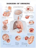 Dangers of Smoking Anatomical Chart Laminated