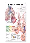 Understanding Asthma Anatomical Chart Laminated