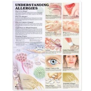 Understanding Allergies Anatomical Chart Laminated