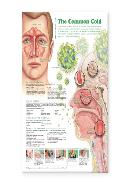Understanding the Common Cold Anatomical Chart Laminated
