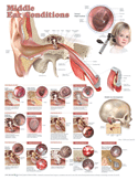 Middle Ear Conditions Anatomical Chart Laminated