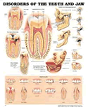 Disorders of the Teeth and Jaw Anatomical Chart Laminated