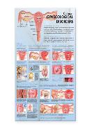 Common Gynecological Disorders Anatomical Chart Laminated