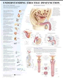 Understanding Erectile Dysfunction Anatomical Chart Laminated