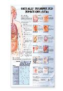 Sexually Transmitted Infections Anatomical Chart  Laminated