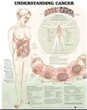 Understanding Cancer Anatomical Chart Laminated