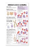 Understanding Leukemia Anatomical Chart Laminated