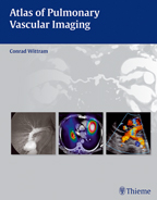 Atlas of Pulmonary Vascular Imaging A Multimodality Approach