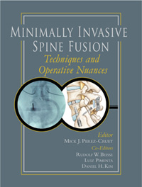 Minimally Invasive Spine Fusion: Techniques and Operative Nuances + 2DVDs 2011