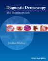 Diagnostic Dermoscopy: The Illustrated Guide 2012