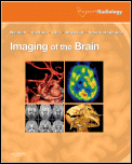 Imaging of the Brain Expert Radiology Series + ExpertConsult