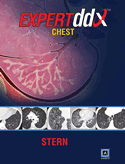 Expert Differential Diagnoses : Chest + E-book