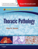 Thoracic Pathology A Volume in the High Yield Pathology Series (Expert Consult - Online and Print) 2012