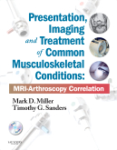 Presentation, Imaging and Treatment of Common Musculoskeletal Conditions Expert Consult MRI-Arthroscopy Correlation 2012