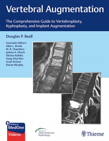 Vertebral Augmentation: The Comprehensive Guide to Vertebroplasty, Kyphoplasty, and Implant Augmentation 2020