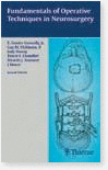 Fundamentals of Operative Techniques in Neurosurgery 2/e